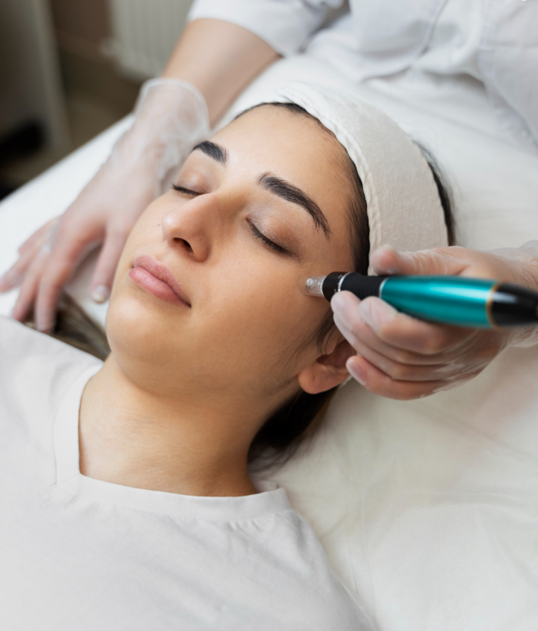 Cryo Pen (Skin Tag Removal)