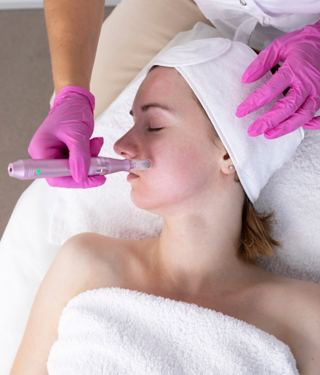 Dermapen Micro-Needling