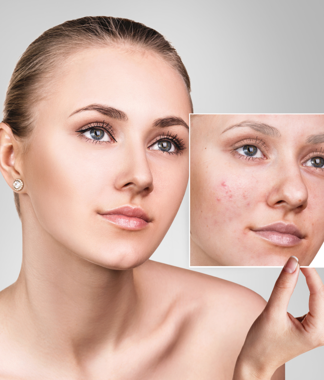 Pigment Perfector Treatment