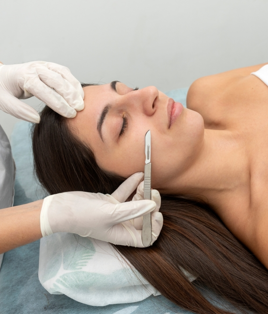 Dermaplanning Treatment